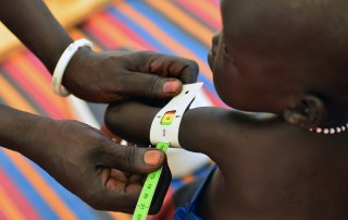 A health worker measures a baby girl’s arm, at an outpatient therapeutic feeding centre at the Protection of Civilians site on the UN peacekeeping mission in South Sudan (UNMISS) base in Malakal, capital of Upper Nile State. Photo: UNICEF/Christine Nesbitt