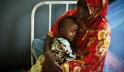 Victims of famine seek treatment at Mogadishu hospital