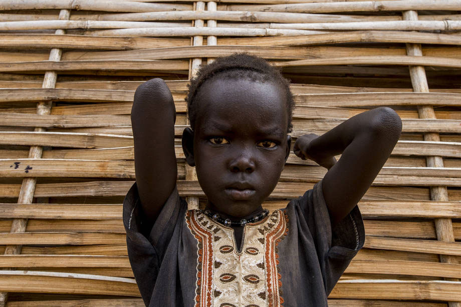 A child in South Sudan where conflict has dramatically worsened food insecurity. UN Photo/JC McIlwaine