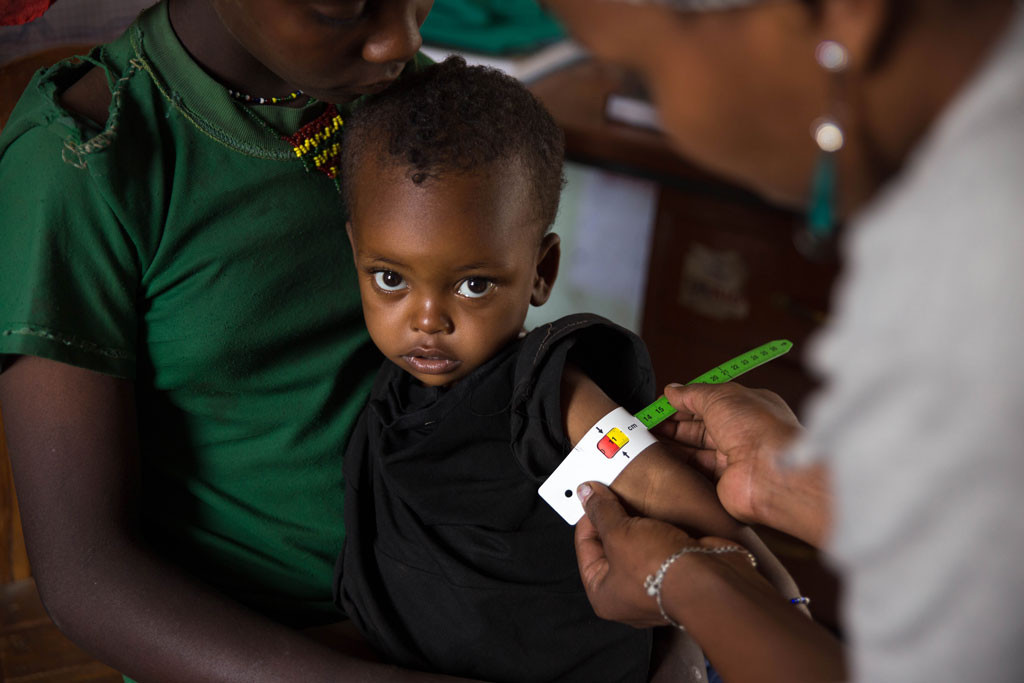 At the Gedebe Health Post in Halaba Special Woreda (district) in SNNP Region of Ethiopia, 28-month-old Nebila has her mid-upper-arm circumference measured by a health worker. She was diagnosed with severe acute malnutrition and has been receiving treatment including ready-to-use-therapeutic food (RUTF). Photo: UNICEF/UN022074/Ayene