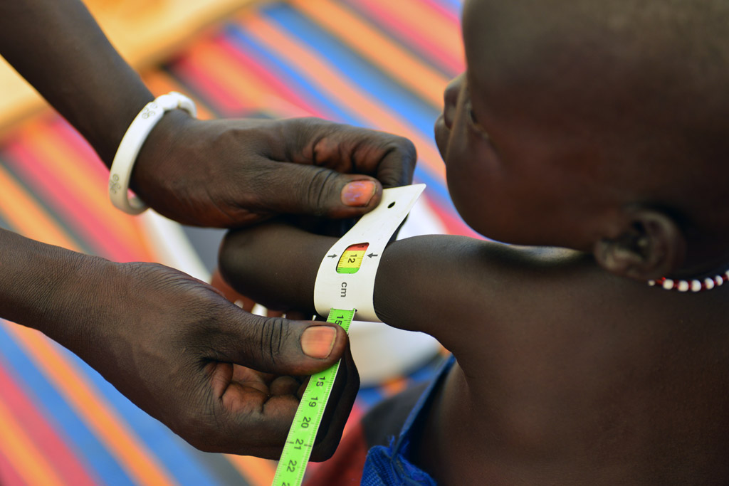 A health worker measures a baby girl’s arm, at an outpatient therapeutic feeding centre at the Protection of Civilians site on the UN peacekeeping mission in South Sudan (UNMISS) base in Malakal, capital of Upper Nile State. Photo: UNICEF/Christine Nesbit