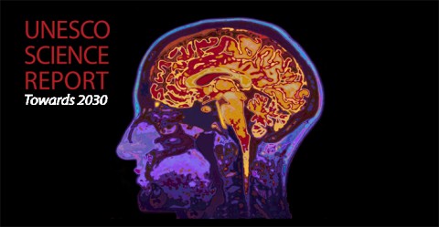 MRI Image Of Head Showing Brain.